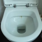 Urinstein Toilette entfernen - Bester Urinsteinlöser bei hartnäckigem Kalkstein