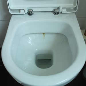 Urinstein Toilette entfernen - Bester Urinsteinlöser bei hartnäckigem Kalkstein