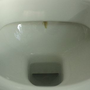 Urinstein Toilette entfernen - Zwischen den Anwendungen