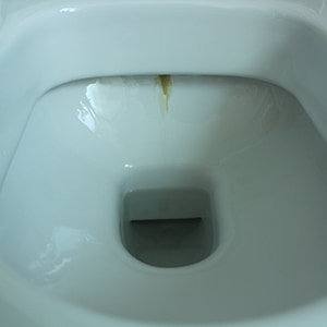 Urinstein Toilette entfernen - vor der 1. Anwendung